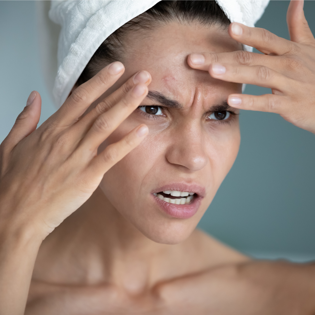 The Stressed Skin Series: Breakouts and Why We Have Them?